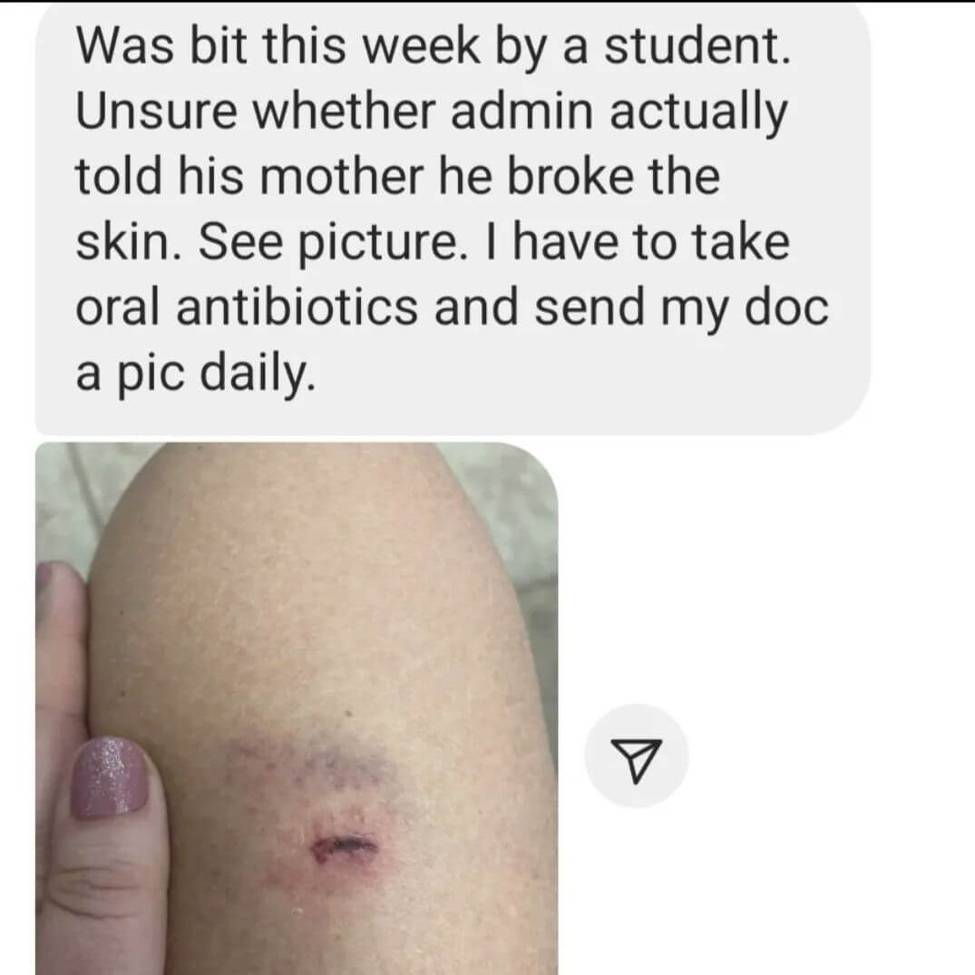 Teacher secret that reads, "Was bit this week by a student. Unsure whether admin actually told his mother he broke the skin. I have to take oral antibiotics and send my doc a pic daily."